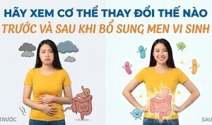 Hãy xem cơ thể thay đổi thế nào trước và sau khi bổ sung men vi sinh