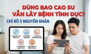 Dùng bao cao su vẫn lây bệnh tình dục? chỉ rõ 5 nguyên nhân