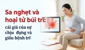  Sa nghẹt và hoại tử búi trĩ: cái giá của sự chịu đựng, giấu bệnh trĩ