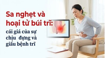  Sa nghẹt và hoại tử búi trĩ: cái giá của sự chịu đựng, giấu bệnh trĩ