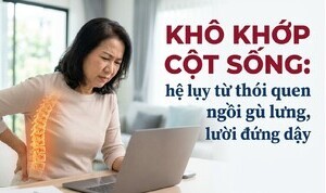 Khô khớp cột sống: hệ lụy từ thói quen ngồi gù lưng, lười đứng dậy