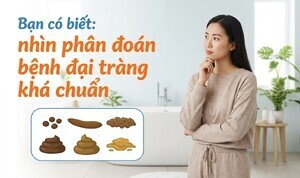 Bạn có biết: nhìn phân đoán bệnh đại tràng khá chuẩn