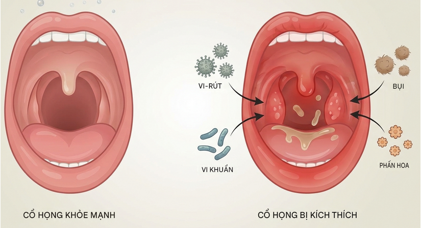 Chỉ mất vài phút: mẹo làm giảm ngứa họng, đau rát họng ai cũng cần