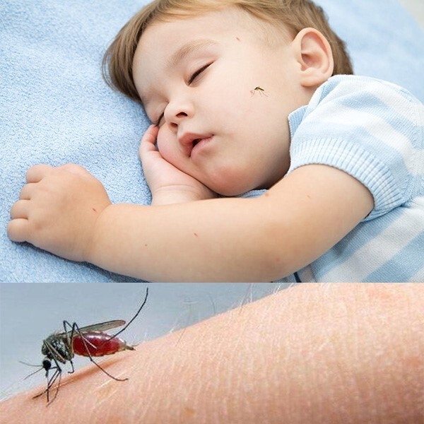 Lăn muỗi thảo dược - cách giảm ngứa, làm dịu da mẹ cần có