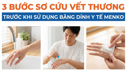 3 bước sơ cứu vết thương trước khi sử dụng Băng dính y tế MENKO
