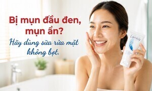 Bị mụn đầu đen, mụn ẩn? Hãy dùng sữa rửa mặt không bọt
