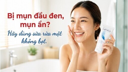 Bị mụn đầu đen, mụn ẩn? Hãy dùng sữa rửa mặt không bọt