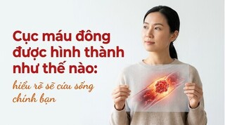 Cục máu đông được hình thành như thế nào: hiểu rõ sẽ cứu sống bạn