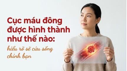 Cục máu đông được hình thành như thế nào: hiểu rõ sẽ cứu sống bạn