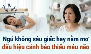 Ngủ không sâu giấc hay nằm mơ: dấu hiệu cảnh báo thiếu máu não