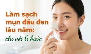 Làm sạch mụn đầu đen lâu năm: chỉ với 6 bước