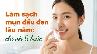 Làm sạch mụn đầu đen lâu năm: chỉ với 6 bước