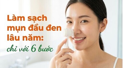 Làm sạch mụn đầu đen lâu năm: chỉ với 6 bước