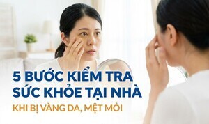 5 bước kiểm tra sức khỏe tại nhà khi bị vàng da, mệt mỏi
