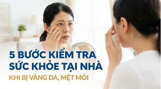 5 bước kiểm tra sức khỏe tại nhà khi bị vàng da, mệt mỏi