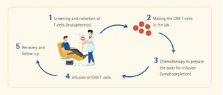 Điều trị bệnh bạch cầu bằng liệu pháp tế bào CAR-T