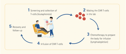Điều trị bệnh bạch cầu bằng liệu pháp tế bào CAR-T