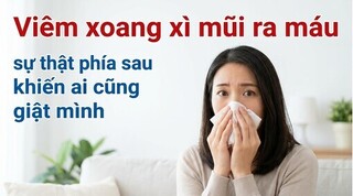 Viêm xoang xì mũi ra máu - sự thật phía sau khiến ai cũng giật mình