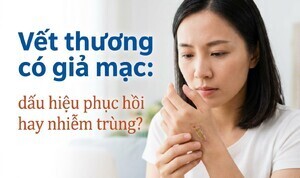 Vết thương có giả mạc: dấu hiệu phục hồi hay nhiễm trùng?