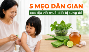 5 mẹo dân gian xoa dịu vết muỗi đốt bị sưng đỏ