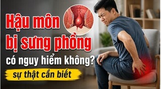 Hậu môn bị sưng phồng có nguy hiểm không? sự thật cần biết