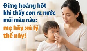 Đừng hoảng hốt khi thấy con ra nước mũi màu nâu: mẹ hãy xử lý thế này