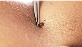 Mỹ: Virus Bourbon được phát hiện ở New York vẫn chưa có thuốc chữa