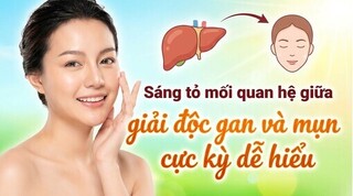 Sáng tỏ mối quan hệ giữa giải độc gan và mụn cực kỳ dễ hiểu