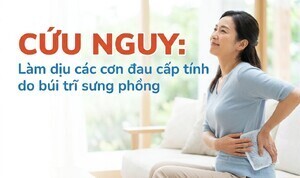 Cứu nguy: làm dịu các cơn đau cấp tính do búi trĩ sưng phồng
