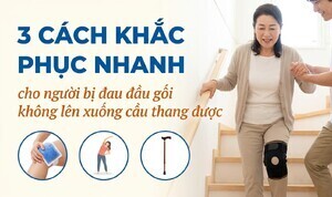 3 cách khắc phục cho người bị đau đầu gối không lên xuống cầu thang