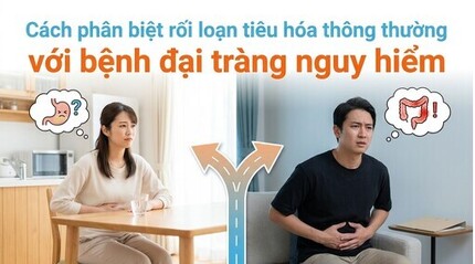 Cách phân biệt rối loạn tiêu hóa thông thường với bệnh đại tràng