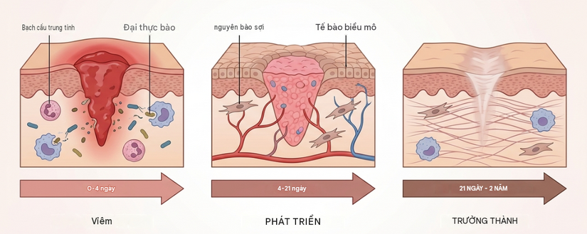 Tìm hiểu chu kỳ để biết chính xác vết thương lành trong mấy ngày