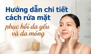 Hướng dẫn chi tiết cách rửa mặt, phục hồi da yếu và da mỏng