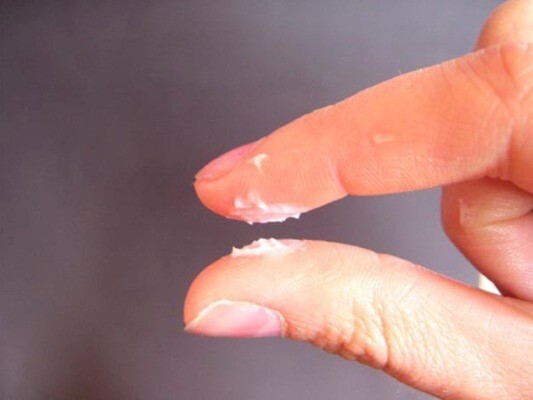 Sai lầm kinh điển khi điều trị nấm vùng kín khiến bệnh dai dẳng mãi
