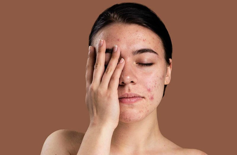 Tại sao ai cũng khuyên da nhạy cảm nên dùng sữa rửa mặt không bọt?