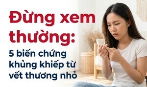 Đừng xem thường: 5 biến chứng khủng khiếp từ vết thương nhỏ