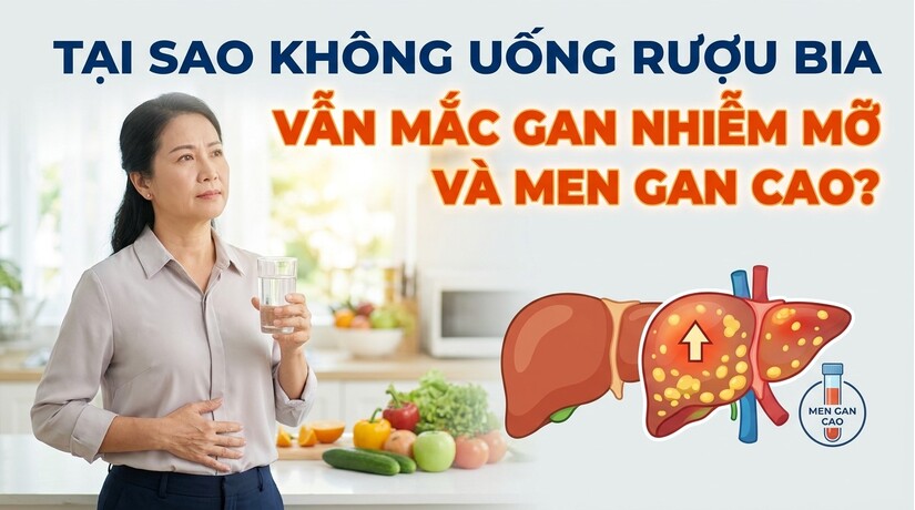 Tại sao không uống rượu bia vẫn mắc gan nhiễm mỡ và men gan cao?