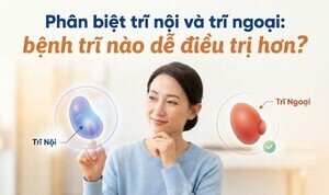 Phân biệt trĩ nội và trĩ ngoại: bệnh trĩ nào dễ điều trị hơn?