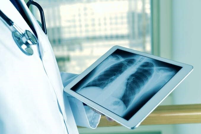 Những tiến bộ trong phẫu thuật lồng ngực: Các phương pháp ít xâm lấn