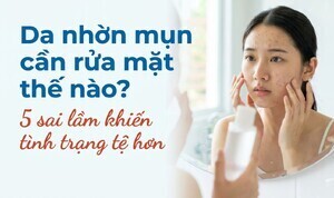 Da nhờn mụn cần rửa mặt thế nào? 5 sai lầm khiến tình trạng tệ hơn