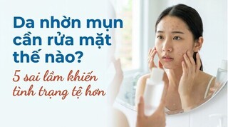 Da nhờn mụn cần rửa mặt thế nào? 5 sai lầm khiến tình trạng tệ hơn