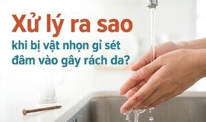 Xử lý ra sao khi bị vật nhọn gỉ sét đâm vào gây rách da?