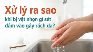 Xử lý ra sao khi bị vật nhọn gỉ sét đâm vào gây rách da?