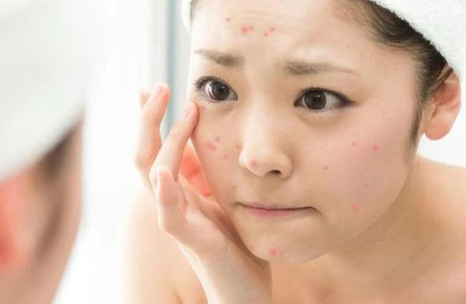 Vạch trần những hiểu lầm tai hại về sữa rửa mặt không bọt