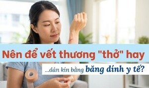 Nên để vết thương 