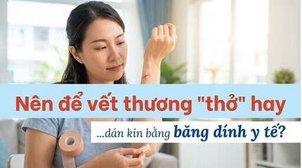Nên để vết thương 