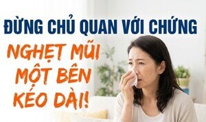 Đừng chủ quan với chứng nghẹt mũi một bên kéo dài!