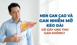 Men gan cao và gan nhiễm mỡ kéo dài có gây ung thư gan không?