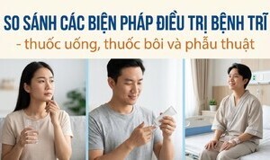 So sánh biện pháp điều trị bệnh trĩ thuốc uống, thuốc bôi, phẫu thuật