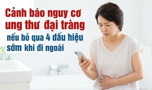 Cảnh báo nguy cơ ung thư đại tràng nếu bỏ qua 4 dấu hiệu khi đi ngoài
